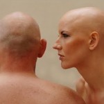 Alopecia Areata Universal