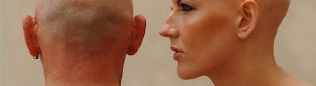Alopecia Areata Universal